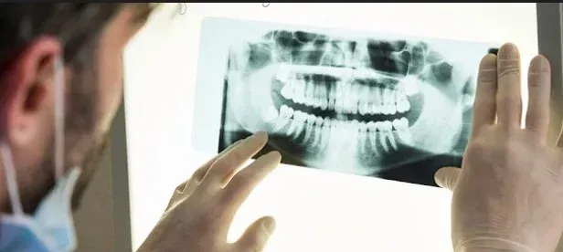 Dental X-ray and diagnostic imaging at HSR Dental Booth, HSR Layout Bengaluru